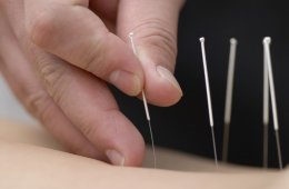 Erectile dysfunction treatment Acupuncture